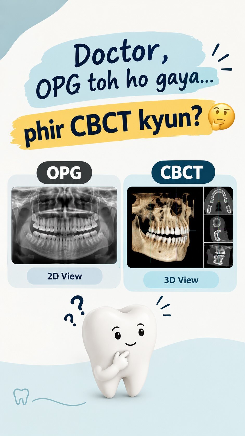 Doctor, OPG toh ho gaya… phir CBCT kyun?🤔🦷

OPG gives a 2D view, while CBCT provides detailed 3D imaging of teeth, bone & surrounding structures.

🔍 Useful for impacted wisdom teeth, implant planning, nerve evaluation & complex dental cases.

⚠️ CBCT isn’t needed for everyone. Your dentist recommends it based on your clinical needs.

📍 House No. B-16, Line of Bank of Baroda, Shailendra Nagar, Raipur, CG – 492001
📞 Appointments: 99935 95795

[ CBCT scan, OPG vs CBCT, 3D dental imaging, dental care Raipur, dentist in raipur, OPG 2D view, Dantcare Digital Dental Clinic ]

#didyouknow #dentalmyths #dentist #dentalcare #dentalfacts